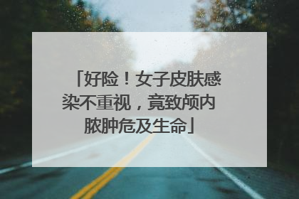 好险！女子皮肤感染不重视，竟致颅内脓肿危及生命